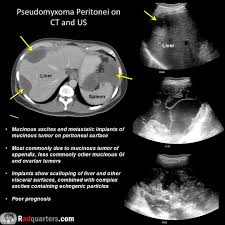 Image result for Pseudoeriosema