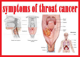 Unlike hard palate cancer, soft palate cancer is a type of throat cancer. Health Feed Health Tips Fitness Tips And Diet Tips Doctoriduniya