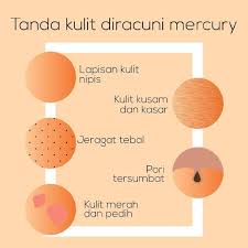 Tekad nak pergi jumpa doktor. Yakin Bahan Dalam Produk Korang Takde Mercury Korang Yakin Kulit Korang Tak Tercemar Dengan Bahan Merbahaya Cuba Korang Check Ada Tak Masalah Macam Ni Pada