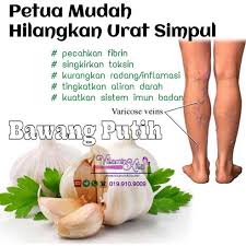 Menghilangkan penampilan varikos, menyentuh kulit, dengan selamat dan berkesan menguatkan dinding urat. Hilangkan Urat Simpul Tips Mudah Dengan Bawang Putih Varicose Veins