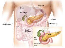 Symptoms are not often noticed until the cancer is big enough to touch and affect organs nearby. Pancreas Cancer Symptoms Australian Pancreatic Cancer Genome Initiative