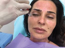 Our mission is to elevate compounding industry standards through a unique combination of superior science and service. Energy Based Microneedling More Than A One Trick Therapy Theaestheticguide Com