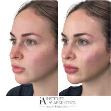 Sidney Mathias BSN, RN, CLT