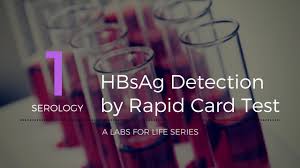 Hbsag Detection By Rapid Card Test Youtube