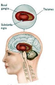 Three Foods To Avoid With Parkinson S Disease Rani Glick Wellness