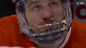 Zach Hyman returns to the game after taking a slap shot to the face from  teammate Evan Bouchard. 😳