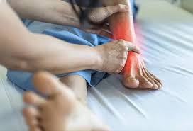 Image result for gout