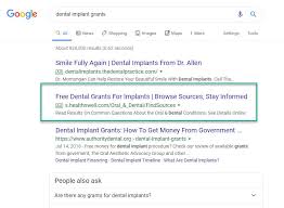 Dental implants can be used to replace a single tooth, several teeth, or all of the teeth. Does Dental Insurance Cover Implants Eon Clinics 2021