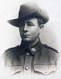 Photos of WW1 Canadian soldiers with tuberculosis needed