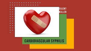 Image result for Cardiovascular Syphilis