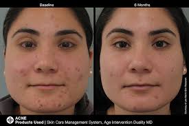 Free shipping for many products! Jan Marini Malmin Skin