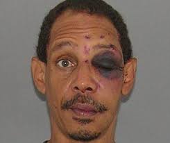 Vânătaia (hematom), care este popular numit, de asemenea, o vânătaie — congestie și stagnarea sângelui coagulat sub piele, care sa format ca urmare a ruperii vaselor de sânge. Ce A PÄƒÅ£it Un HoÅ£ Ghinionist Care A Vrut SÄƒ JefuiascÄƒ Un Boxeur Evenimentul Zilei