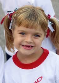 I have a rare genetic condition. Seeing it