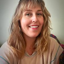 Do people with Ehlers Danlos Syndromes experience spider veins, posture  issues, and eye problems?