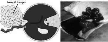 Various products offer a choice of. Http Www Downstatesurgery Org Files Cases Abdominal Wall Defect Pdf