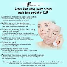 Dec 08, 2020 · 1 reaksi awal pemakaian ms glow. Kalian Tentunya Berharap Mendapatkan Mraskin Glow Yuni Facebook