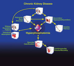 Image result for Hyperphosphatemia