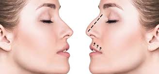Dr Miami Rhinoplasty Review And Comparison Dr Miami Prices