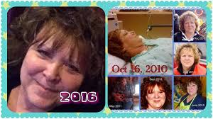 Things to know about brain injury and adjusting