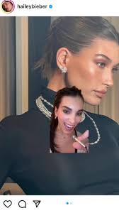 Hailey Bieber Nose Transformation Revealed