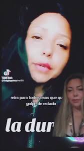 Pata Daisy Venezolanas