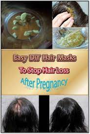 Hair loss after pregnancy or childbirth is not a major problem; Pin On Health