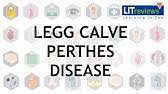 The osteochondroses typically are characterized by degeneration and subsequent nochimson gf. Legg Calve Perthes Disease Mayo Clinic Youtube