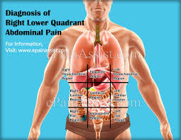In anatomy and physiology, you'll learn about the four abdominal quadrants and nine abdominal regions. What Can Cause Right Lower Quadrant Abdominal Pain How Is It Treated