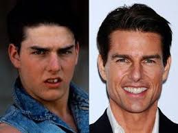 See more ideas about tom cruise young, tom cruise, cruise. How Does Tom Cruise Maintain His Youthful Looks Even At 54 Quora