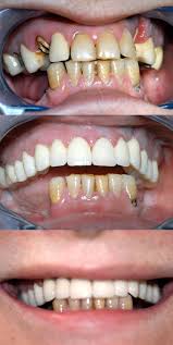 Pin On Dental Cases