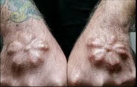Watch short videos about #bodymodification on tiktok. Shocking Pictures Self Styled Transhumanist Makes Bizarre Tech Modifications To His Body