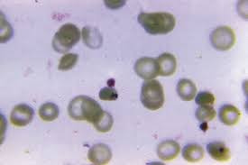 And what you will observe are the infective form of the malaria parasites, 00:08:01.00 the sporozoites, being released from the tip of the proboscis into the saliva. African Parasite Shows Signs Of Resistance To Widely Used Malaria Treatment News In Brief Pharmaceutical Journal