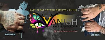 Texas laser institute the worldwide leader in aesthetics training. Vanish Laser Aesthetics East Texas Tattoo Removal Clinic