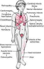 Pin On Nursing