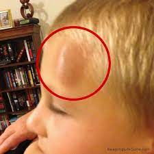How I Stopped My Child From Being Clumsy - Keeping Life Sane