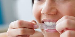 It's also important to brush and floss regularly, limit staining beverages, and avoid smoking to maintain white teeth. Teeth Whitening Best Kits Strips Toothpaste Home Remedies