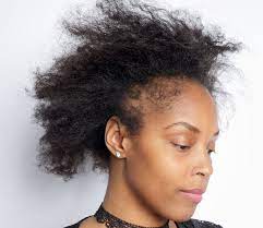 These headbands will often start to cause breakage of your hair along the hairline, which results in tiny painful tugs of the baby hair and hair loss. What Black Women Need To Know About Hair Loss The New York Times