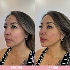 The sound is just so spooky 👻 I hate running behind but I also hate not  taking my sweet time with my patients 😩. I'm just gna need 3 hours with  every