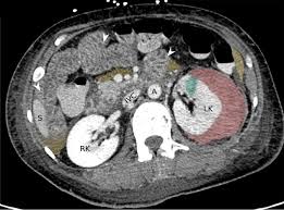 Image result for Genitourinary Trauma