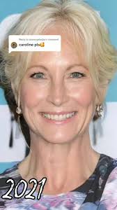 Candice Nelson Before and After