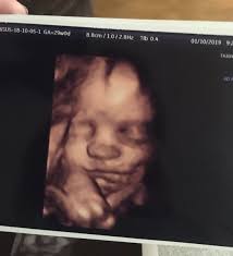 Ivy Horner (@LivelyIvy420)