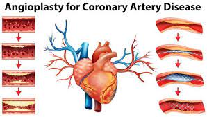 Pin On Best Treatment Cost In Chennai