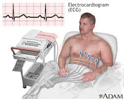 Image result for Electrocardiogram