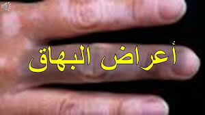 أعراض البهاق youtube