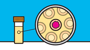 Urine Tests Detecting Cancer Early In Pee Cancer Research Uk Science Blog