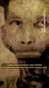 Çenesi kopana kadar radyum içen adam: Eben Byers #belgesel #tarih #shorts