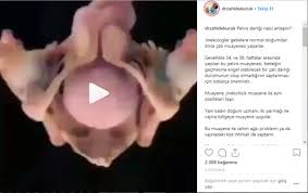 Op Dr Zahide Kucuk Yorumlari Incele Ve Randevu Al Doktortakvimi Com