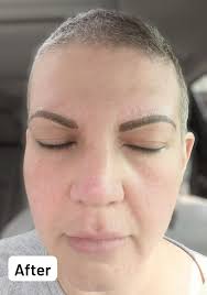 Do I have to pump and dump after eyebrow embroidery?