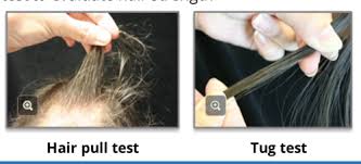 Image result for Hair Pull Test