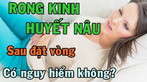 Huyết nâu rong kinh sau đặt vòng tránh thai có đáng lo ngại không?